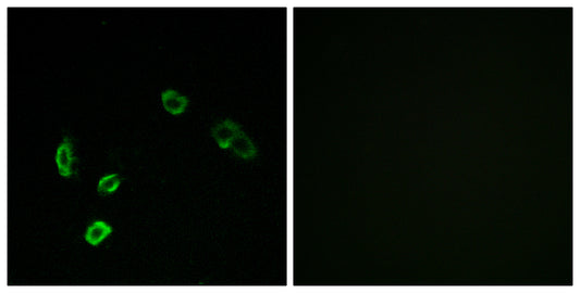 Olfactory receptor 5H15 Rabbit Polyclonal Antibody