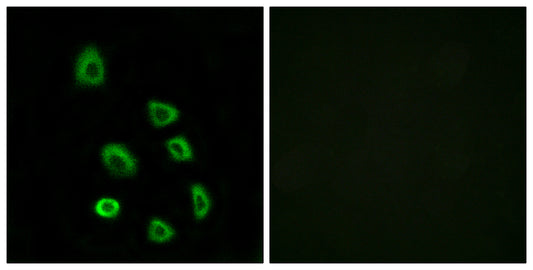 Olfactory receptor 5K1 Rabbit Polyclonal Antibody