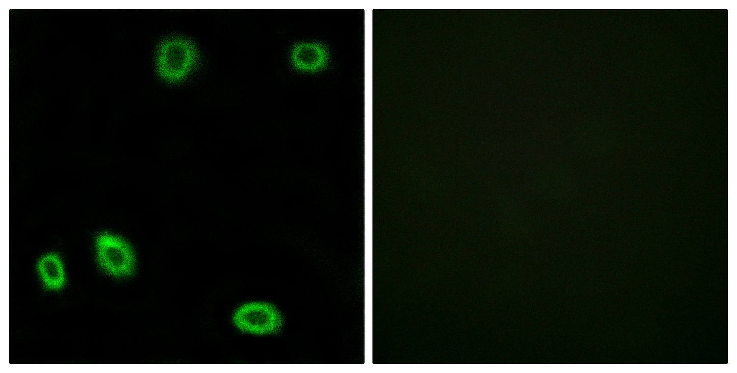Olfactory receptor 5L1/2 Rabbit Polyclonal Antibody