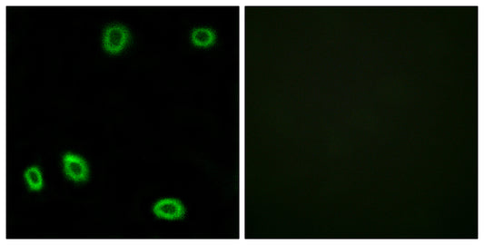 Olfactory receptor 5L1/2 Rabbit Polyclonal Antibody