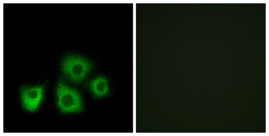 Olfactory receptor 5M1/5M10 Rabbit Polyclonal Antibody