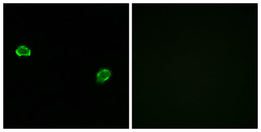 Olfactory receptor 5M3 Rabbit Polyclonal Antibody