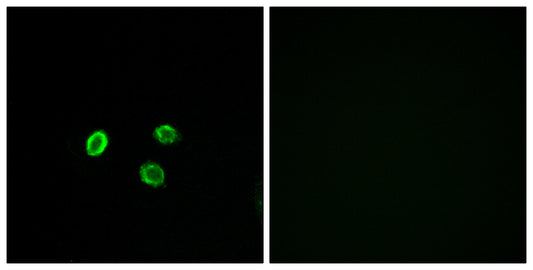 Olfactory receptor 5M9 Rabbit Polyclonal Antibody