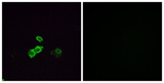 Olfactory receptor 5U1 Rabbit Polyclonal Antibody