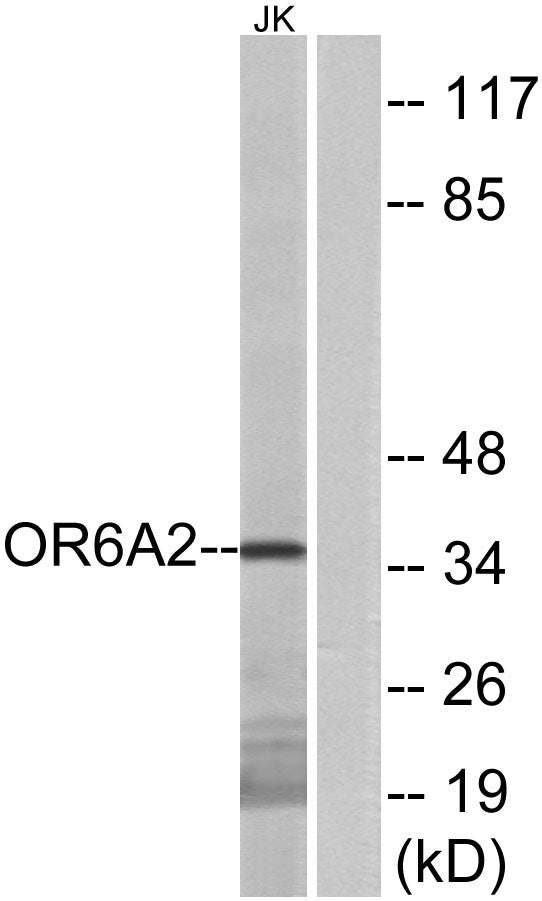 Olfactory receptor 6A2 Rabbit Polyclonal Antibody
