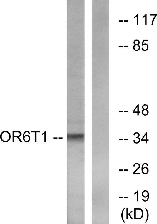 Olfactory receptor 6T1 Rabbit Polyclonal Antibody