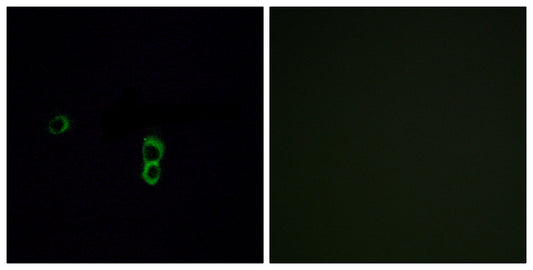 Olfactory receptor 9Q1 Rabbit Polyclonal Antibody