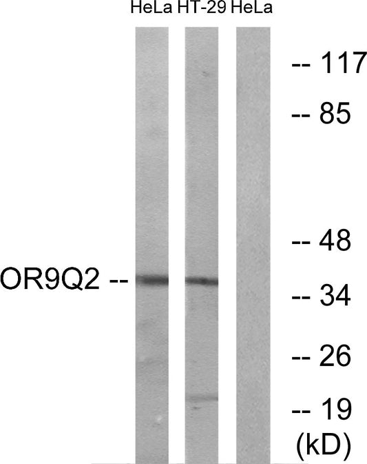 Olfactory receptor 9Q2 Rabbit Polyclonal Antibody
