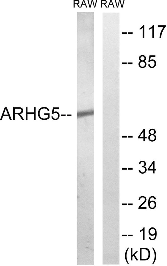 Oncogene TIM Rabbit Polyclonal Antibody