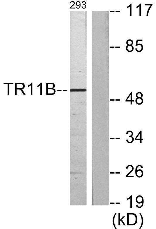 OPG Rabbit Polyclonal Antibody