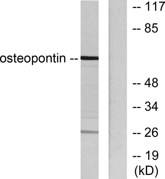 OPN Rabbit Polyclonal Antibody