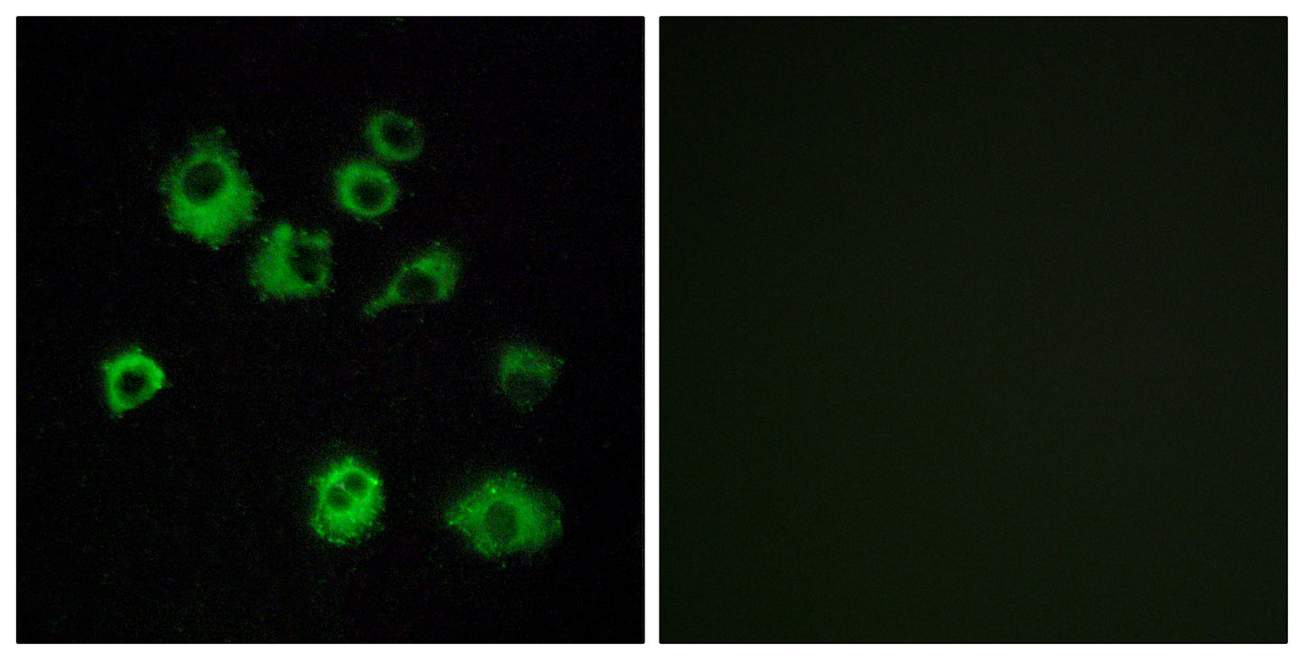 Orexin R-1 Rabbit Polyclonal Antibody