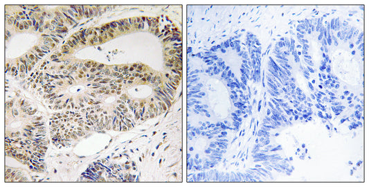 OSR1 Rabbit Polyclonal Antibody