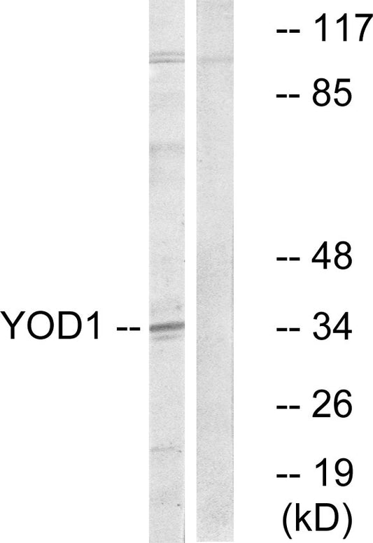 OTUD2 Rabbit Polyclonal Antibody