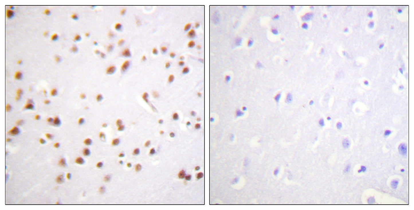 p120 Rabbit Polyclonal Antibody