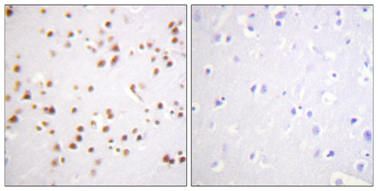 p120 Rabbit Polyclonal Antibody