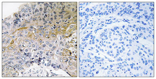 p130 Cas Rabbit Polyclonal Antibody