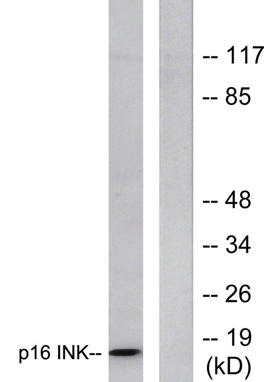 p16 Rabbit Polyclonal Antibody
