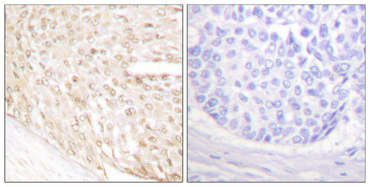 p18 Rabbit Polyclonal Antibody