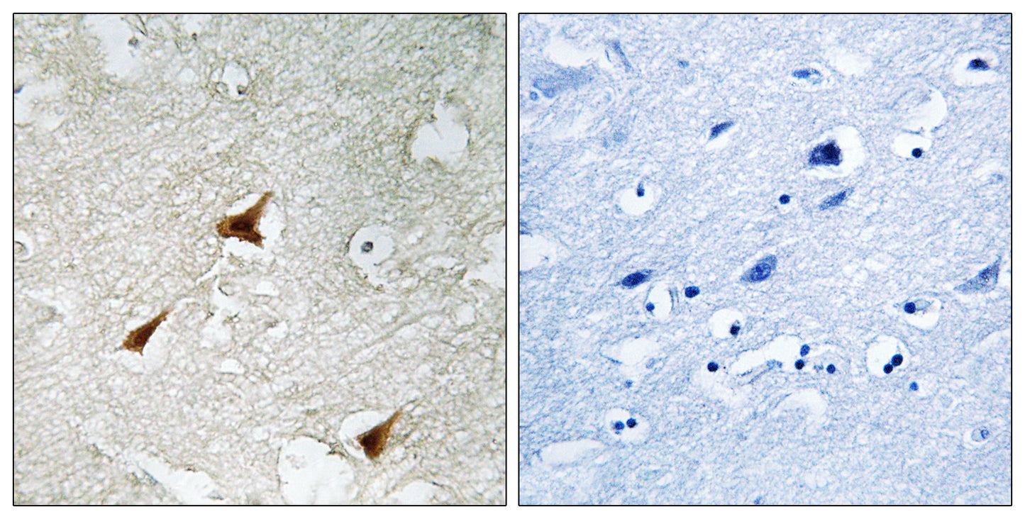 p19 Rabbit Polyclonal Antibody
