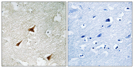 p19 Rabbit Polyclonal Antibody