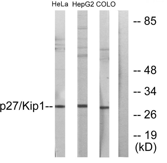 p27 Rabbit Polyclonal Antibody