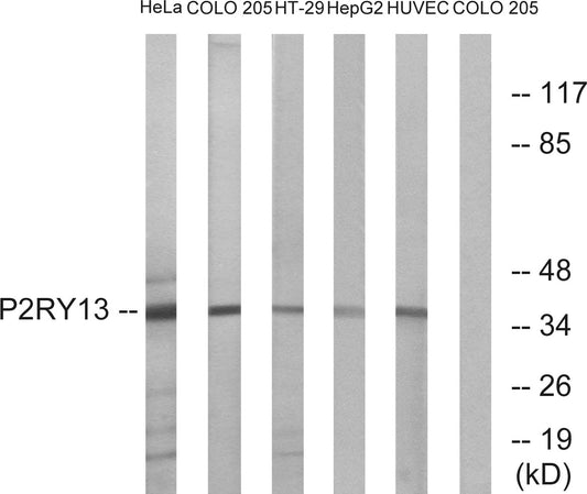 P2RY13 Rabbit Polyclonal Antibody