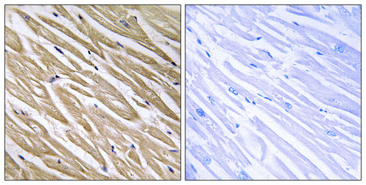 P311 Rabbit Polyclonal Antibody