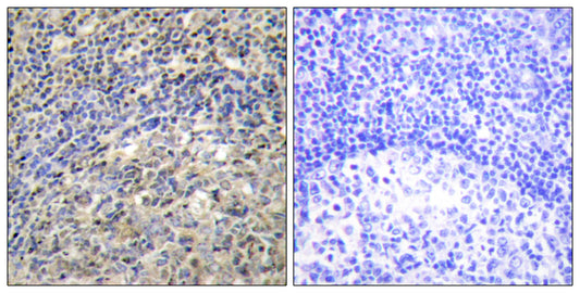 p47-phox Rabbit Polyclonal Antibody