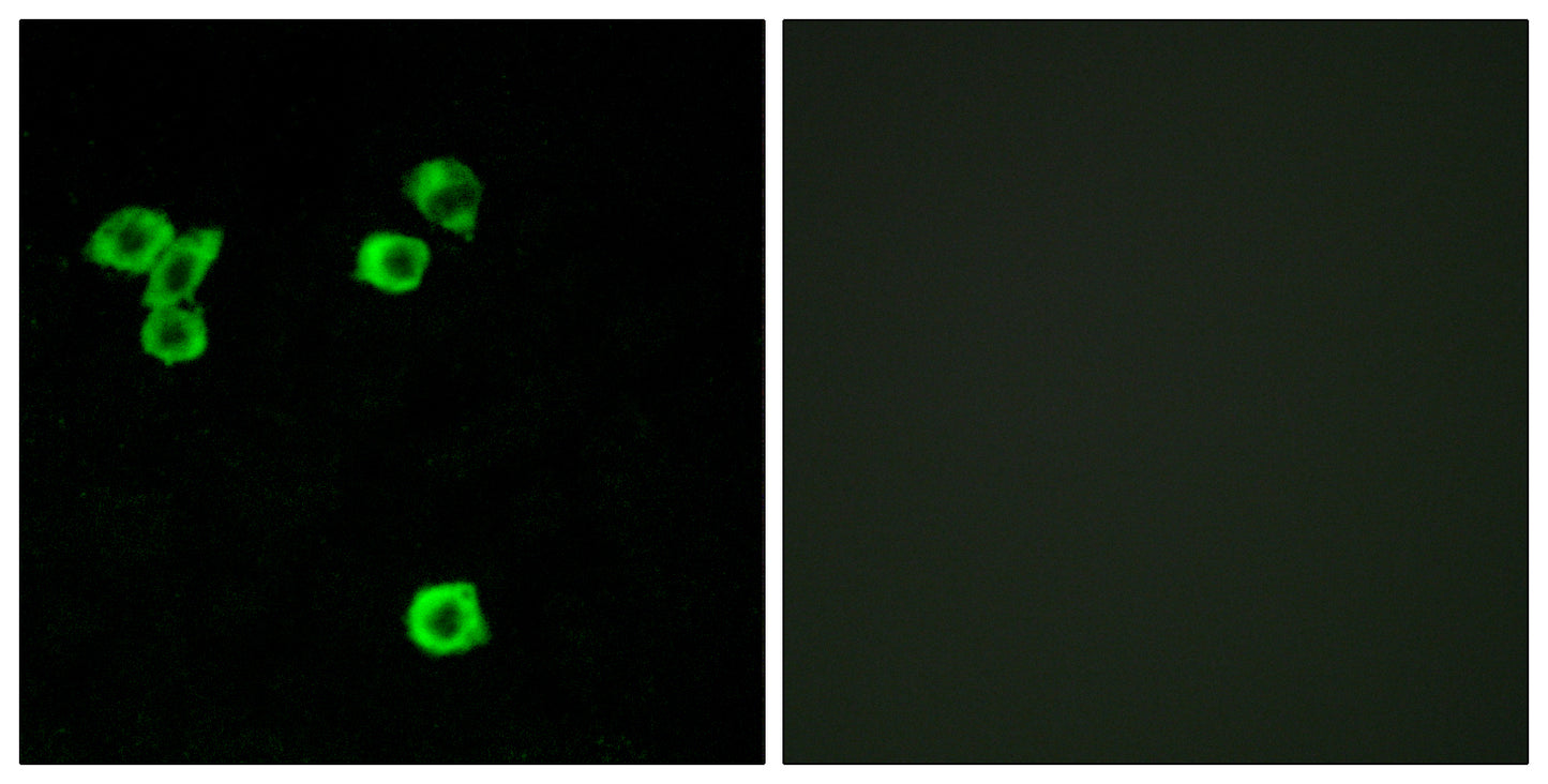 p52 S6 kinase Rabbit Polyclonal Antibody