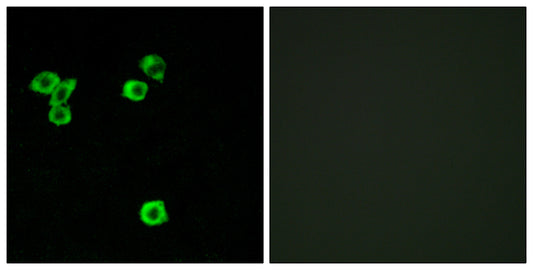 p52 S6 kinase Rabbit Polyclonal Antibody