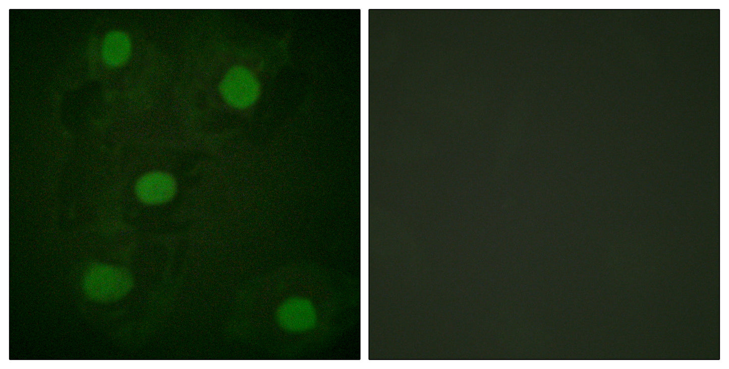 p53 Rabbit Polyclonal Antibody