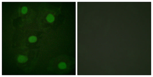 p53 Rabbit Polyclonal Antibody
