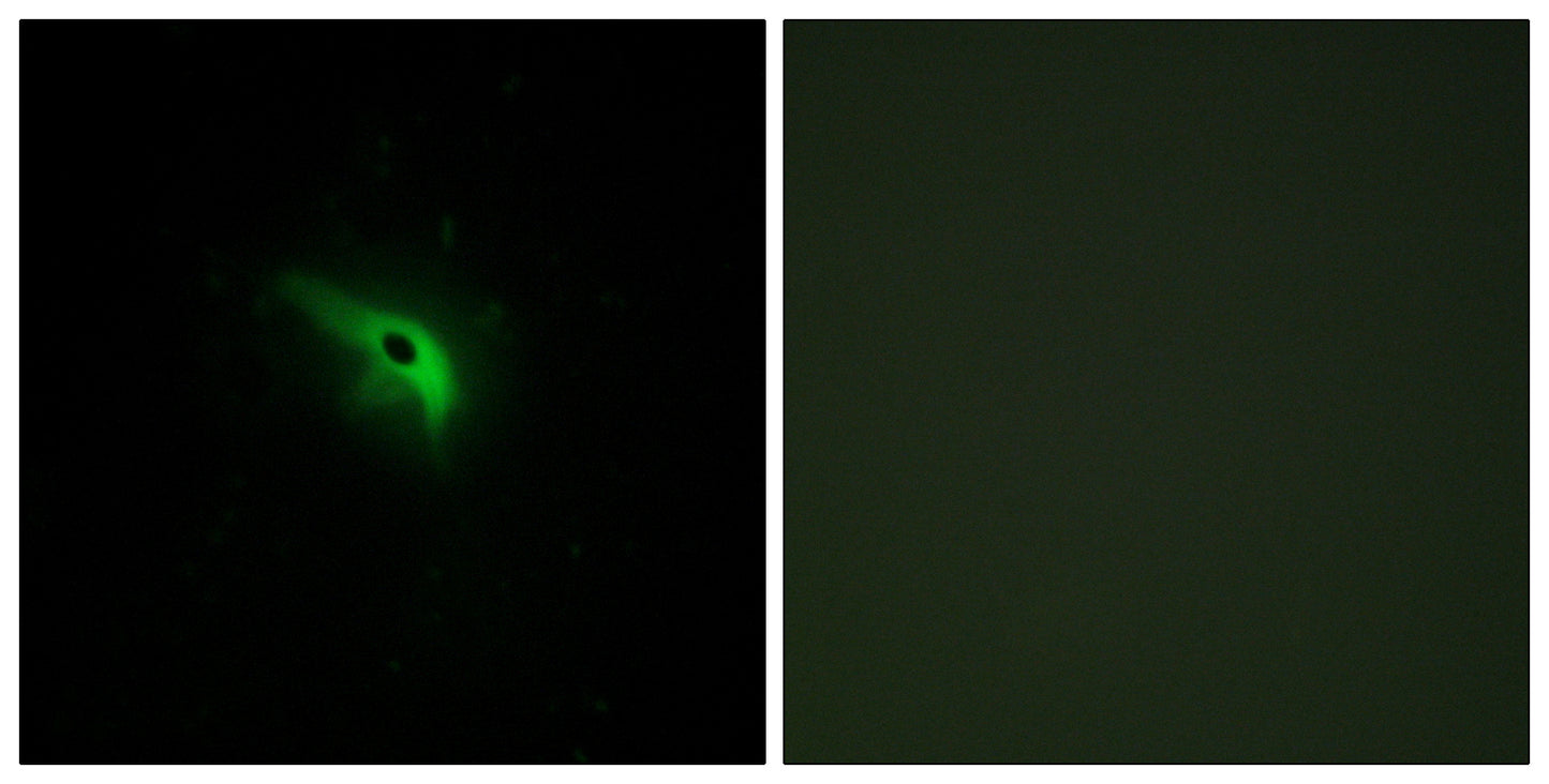 p53AIP1 Rabbit Polyclonal Antibody