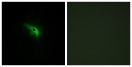 p53AIP1 Rabbit Polyclonal Antibody
