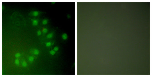p63 Rabbit Polyclonal Antibody
