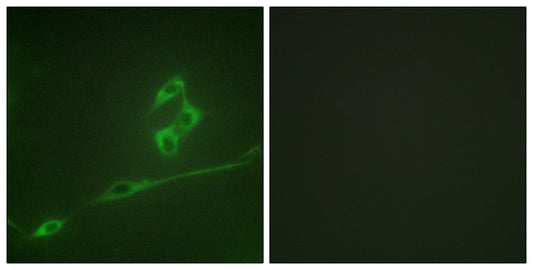 p70 S6 kinase α Rabbit Polyclonal Antibody