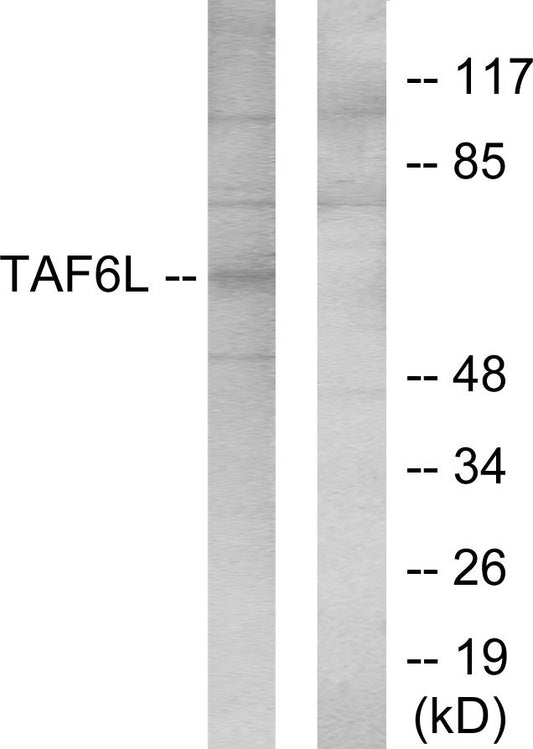 PAF65α Rabbit Polyclonal Antibody