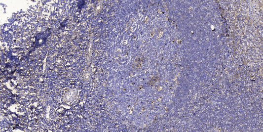 PAGE-3 Rabbit Polyclonal Antibody