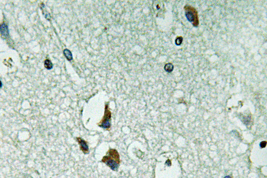 PAH Rabbit Polyclonal Antibody