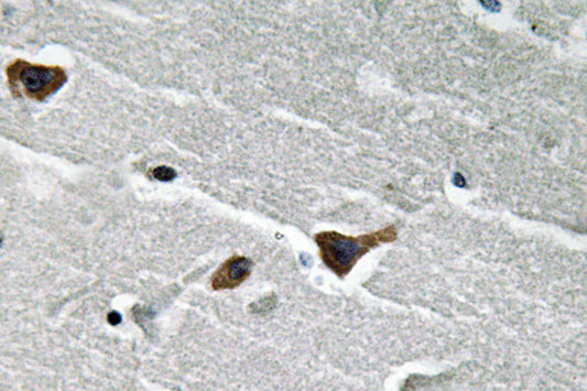 PAI-1 Rabbit Polyclonal Antibody