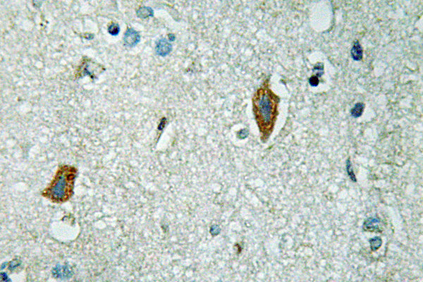 PAI-2 Rabbit Polyclonal Antibody