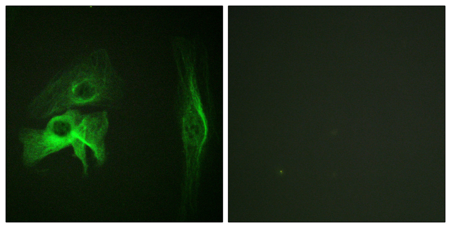 PAKα Rabbit Polyclonal Antibody