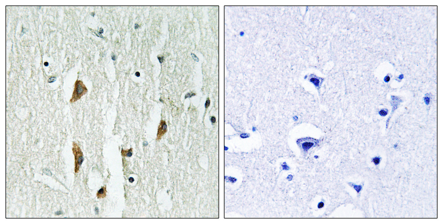 PAKα/β/γ Rabbit Polyclonal Antibody
