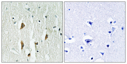 PAKα/β/γ Rabbit Polyclonal Antibody