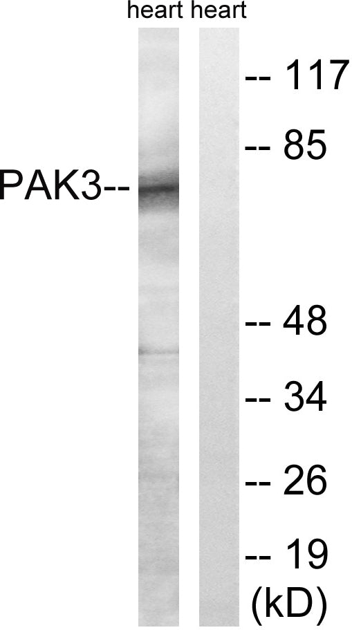 PAKβ Rabbit Polyclonal Antibody