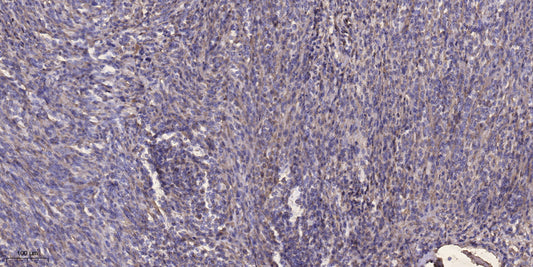 Palladin Rabbit Polyclonal Antibody