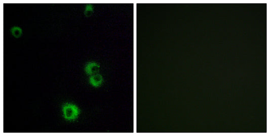 PAR-3 Rabbit Polyclonal Antibody