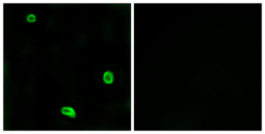 PAR-4 Rabbit Polyclonal Antibody