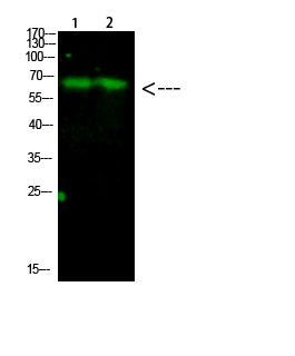 Parafibromin Rabbit Polyclonal Antibody